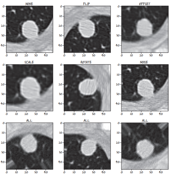 Visualizing 3D Augmentation Variations on CT Nodule Slices