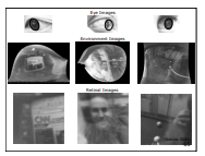 Corneal Reflection Analysis