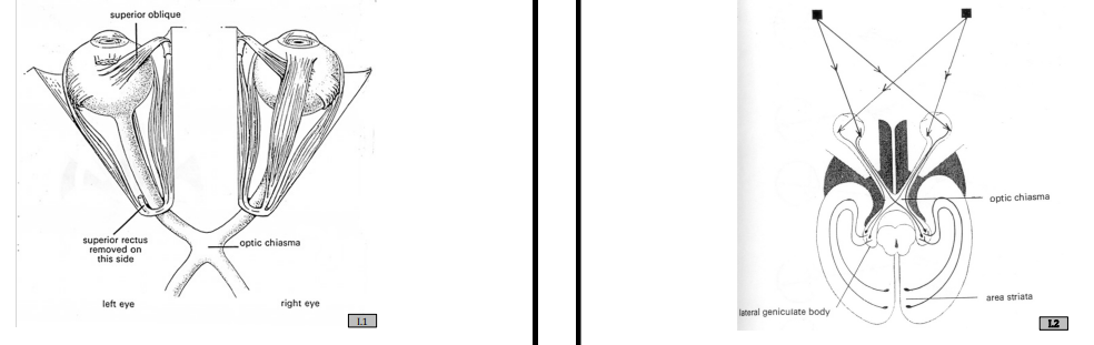 Human Visual System Optics and LGN